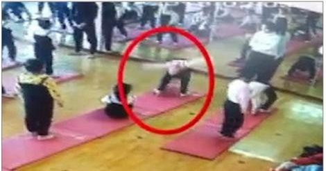 Tập yoga sai cách, bé gái 4 tuổi bị liệt nửa người