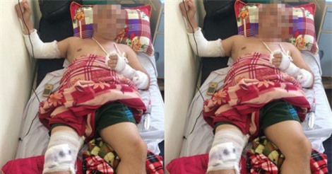 Nghệ An: Đi ăn đêm, người đàn ông bị chém gục tại quán