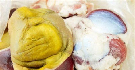 Màng mề gà - 'bảo bối' chữa bệnh mà bạn chưa biết