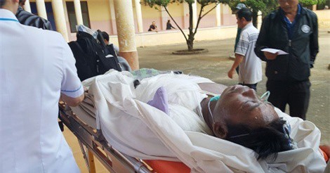 Vợ tạt nước sôi chồng trong lúc đang ngủ khiến 2 cha con bỏng nặng