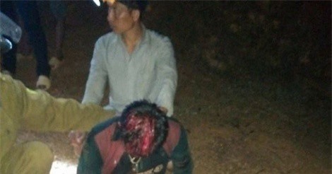 NÓNG 8/3: Chồng dùng dao chém cả vợ lẫn con gái rồi tự tử bất thành ở Nghệ An