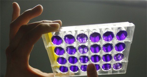 Mỹ tham vọng phát triển công nghệ "làm chậm cái chết"