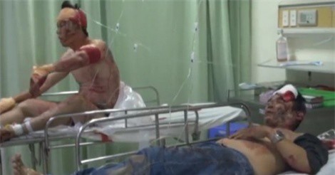 Bến Tre: Hỗn chiến lúc nửa đêm khiến 3 người nhập viện chỉ vì... thuê phòng không đưa CMND