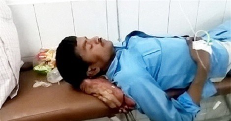 SỐC: Bác sĩ để bệnh nhân gối đầu bằng chính chân bị gãy 