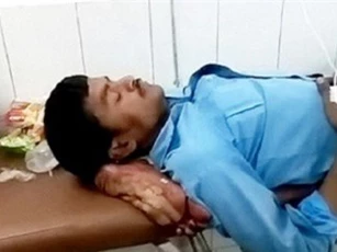 SỐC: Bác sĩ để bệnh nhân gối đầu bằng chính chân bị gãy