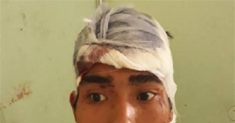 Khởi tố kẻ phê ma túy sát hại con gái, chém trọng thương vợ