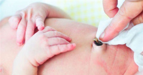Cách vệ sinh rốn cho trẻ sơ sinh nhanh chóng mẹ cần phải biết
