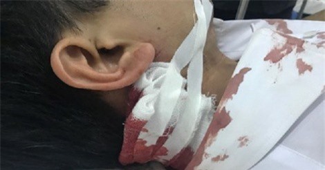 Thiếu tá công an bị đối tượng dùng dao bầu đâm ngay cổng trụ sở làm việc