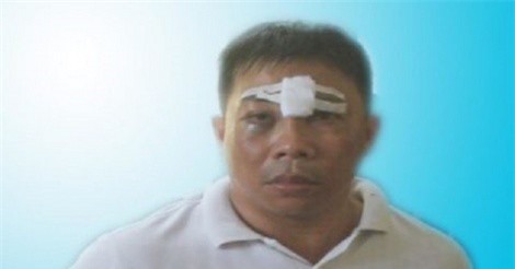 Phú Yên: Phạt tù giáo viên thua độ đi cướp giật