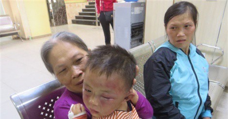 Nghệ An: Triệu tập bố dượng nghi hành hung con riêng 2 tuổi của vợ nhập viện