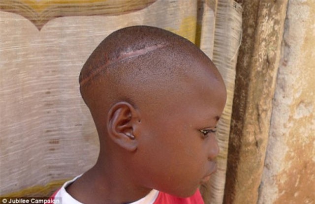 Rợn người với hủ tục hiến tế trẻ em ở Uganda