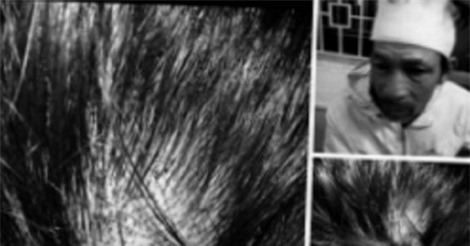 Quảng Ngãi: Phó Bí thư Đảng ủy xã bị “tố” hành hung dân phải nhập viện