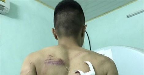 Quảng Ninh: Một phụ nữ tổ chức bắt giữ người tình siết nợ, tống tiền