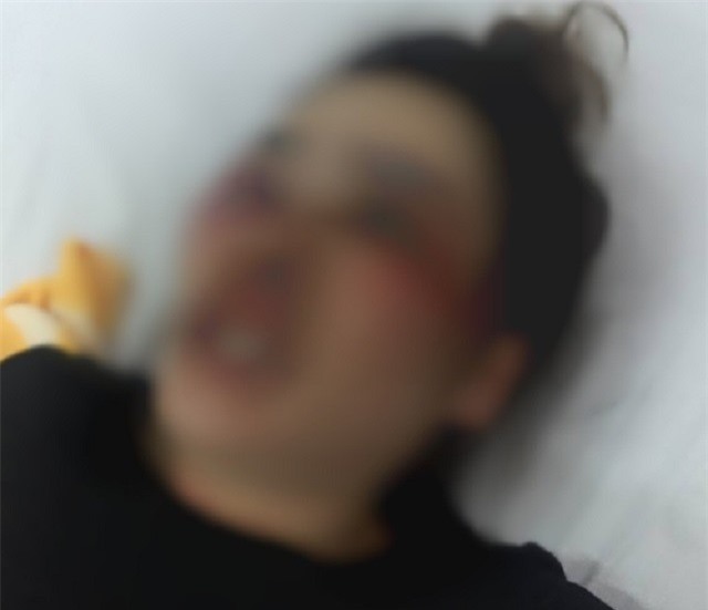 Đà Nẵng: Mâu thuẫn trong quán bánh xèo, nam sinh đánh người phụ nữ nhập viện