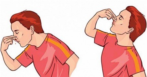 Mẹo chữa chảy máu cam tại nhà nhanh chóng và hiệu quả