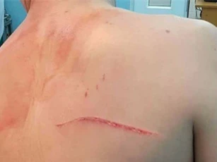 Một bác sĩ bị chém 2 nhát ở trung tâm TP.HCM