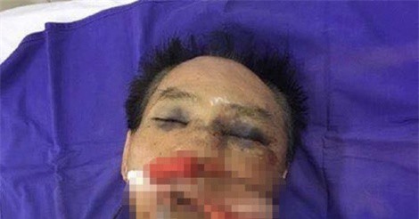 Khởi tố nguyên đại tá công an cùng con trai đánh anh ruột tử vong