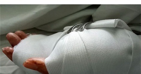 Cô gái bị chém gần đứt lìa bàn tay trong quán game