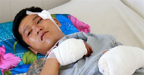 Khánh Hòa: Nhân viên công ty du lịch nhập viện vì bị truy sát