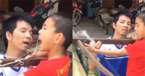 Clip: Nhổ răng bằng... nỏ, cậu bé Việt Nam lên báo Anh
