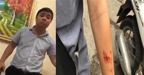 Clip: Giám đốc Trung tâm gia sư cầm dao đe dọa, hành hung khiến 2 sinh viên nhập viện