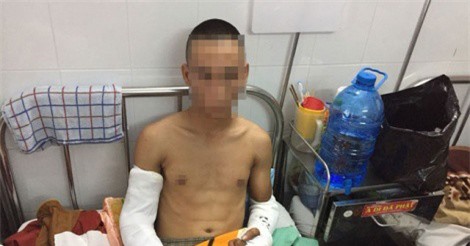 Đang uống cà phê, nhóm thanh niên bị côn đồ truy sát dã man 