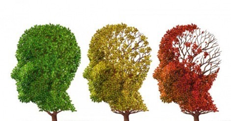 Thiếu ngủ làm tăng nguy cơ bệnh Alzheimer