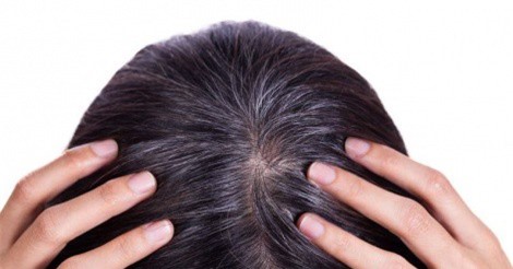 3 cách trị tóc bạc sớm bằng những nguyên liệu dân gian