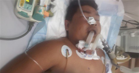 Người đàn ông bị giết vì nghi trộm chó