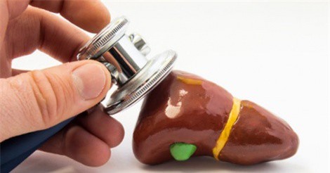 Nguyên nhân khiến men gan tăng cao và cách điều trị