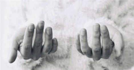 Thói quen cắn móng tay có thể dẫn đến nhiễm trùng chết người