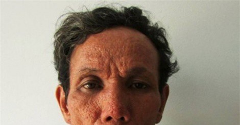 Truy tố nghịch tử đánh chết mẹ già 86 tuổi bị liệt hai chân