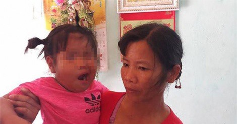 Nghi vấn bé gái 3 tuổi bị cô giáo tát liệt dây thần kinh, méo mặt