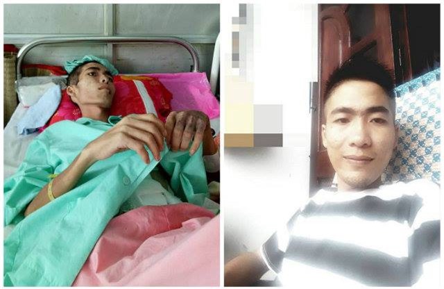 Nặng 28kg nằm liệt giường người chỉ còn da bọc xương, 9X Vũng Tàu “lột xác vi diệu”