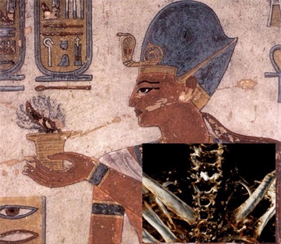 Sự thật ngỡ ngàng về xác ướp pharaoh Ai Cập Ramesses III