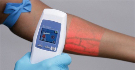 Trong tương lai Face ID sẽ được quét bằng mạch máu