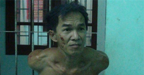 Đưa nghi phạm chém lìa đầu hàng xóm đi giám định tâm thần