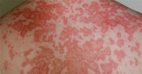 7 căn bệnh nguy hiểm thường gặp ở phụ nữ