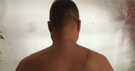 Mâu thuẫn làm ăn, giám đốc doanh nghiệp bị chém giữa ban ngày