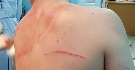 Thuê người truy sát chồng, vợ cũ của bác sĩ Chiêm Quốc Thái bị bắt khẩn cấp