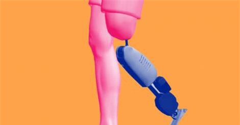 Đã có thể chế tạo ra chân tay giả đem lại cảm giác như thật cho con người