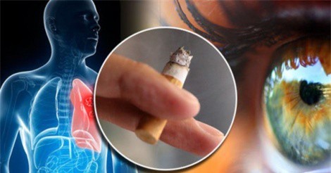 Hút thuốc lá gây nên các bệnh về mắt
