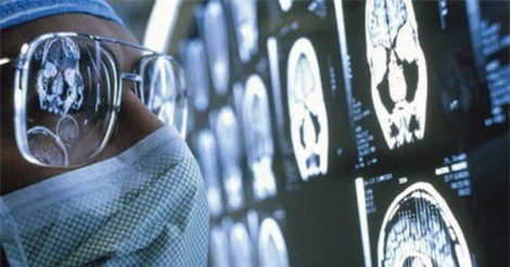 Vắc xin mới có thể kéo dài gấp đôi thời gian sống của bệnh nhân u não
