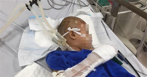 Người đàn ông ngáo đá chém trọng thương bé trai chín tuổi