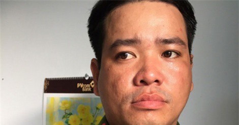 Giả danh đại úy công an, lừa đảo chiếm đoạt tài sản