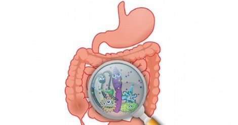 Chế độ ăn có thể giúp giảm cơn co giật