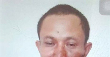 Nghệ An: Chém chủ nhà 17 nhát sau khi bị phát hiện trộm tài sản trong đêm