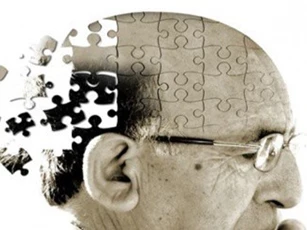 Béo phì có thể liên quan tới khởi phát sớm bệnh Alzheimer