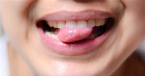 Bài massage đơn giản giúp răng khỏe