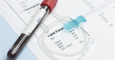 Giải đáp 6 thắc mắc thường gặp về cholesterol